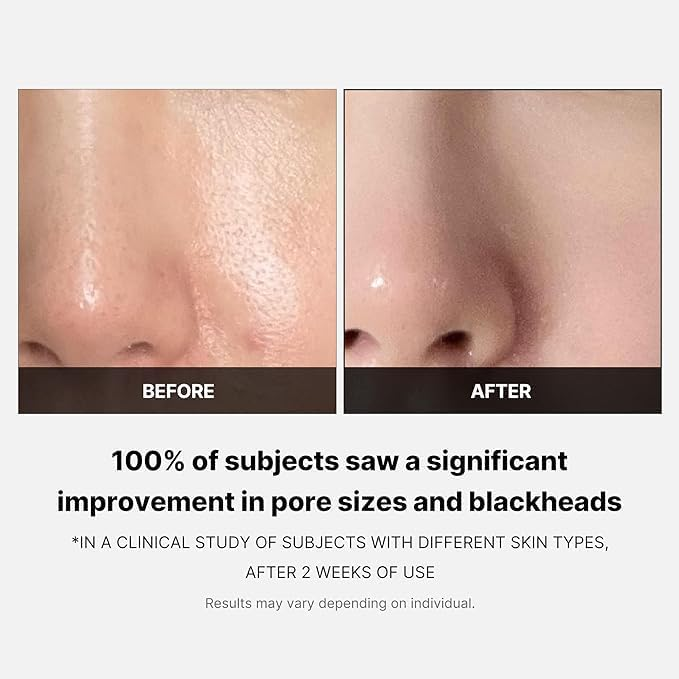 Zero Pore Pads