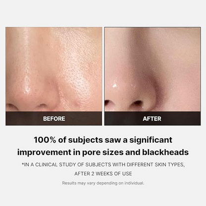 Zero Pore Pads